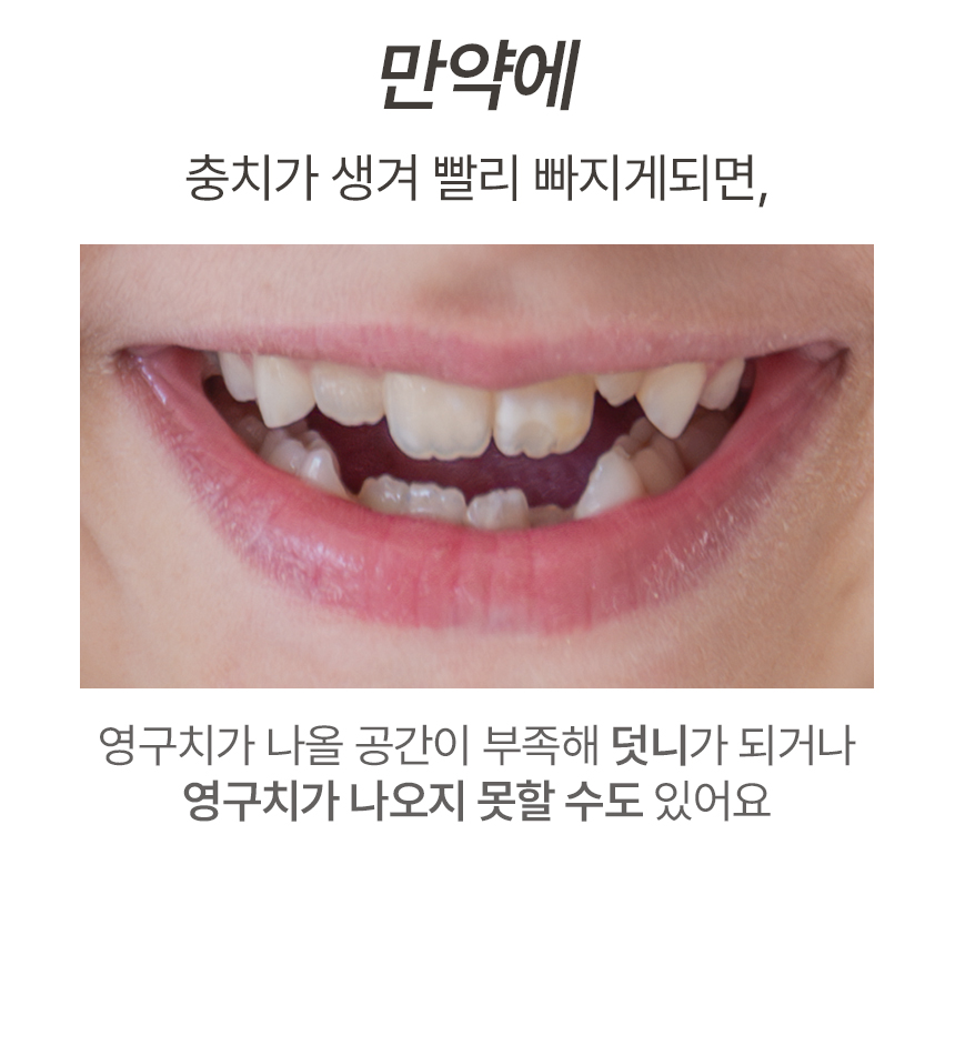 얇은치실 어린이전용 베베스케일링 44개X1봉지_(969612) 상세 이미지 9