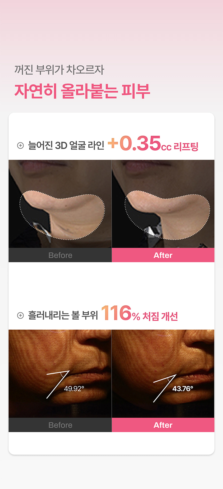 coffret crème rétinol appareil meditherapy k-beauty