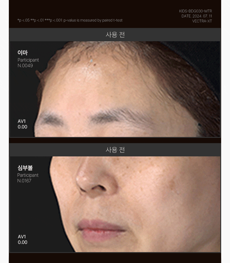 coffret crème rétinol appareil meditherapy k-beauty