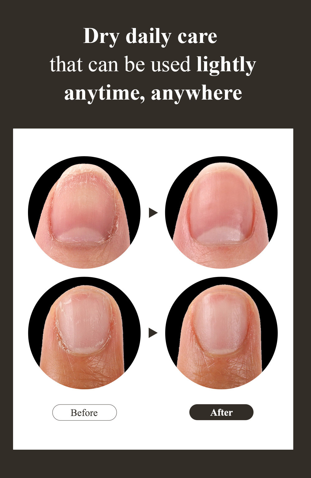[Root] Double Effect Nail Oil | NAIL CARE - Nail Polish & Colors Korean ...
