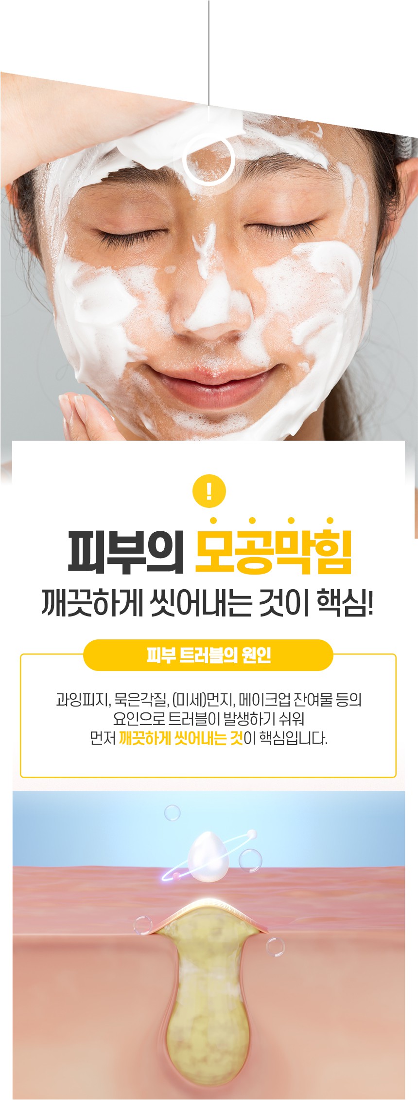 [티샤] AC7 여드름성 피부 완화 기능성 폼클렌징 100g 1+1 상세 이미지 5