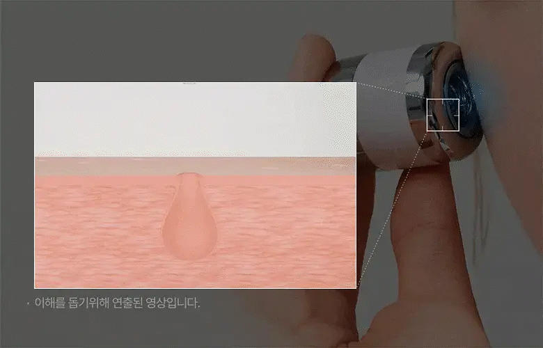 sérum exosome meditherapy k-beauty