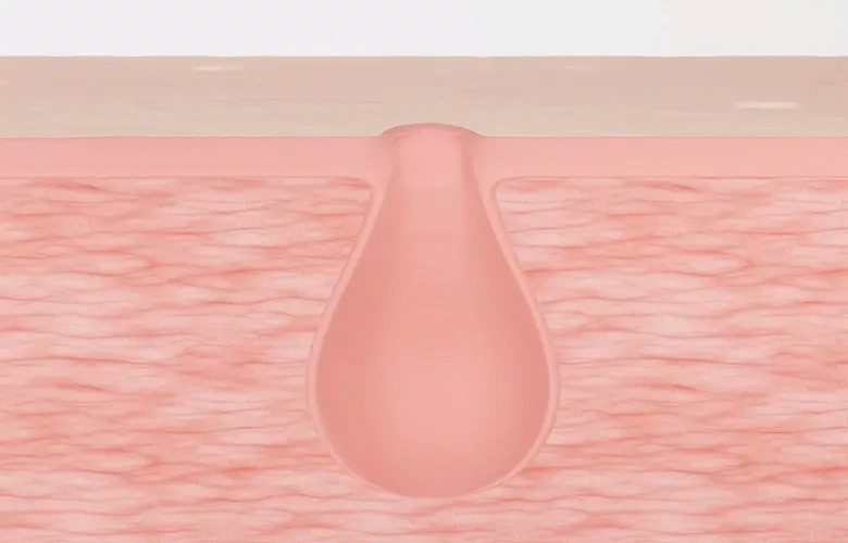 sérum exosome meditherapy k-beauty