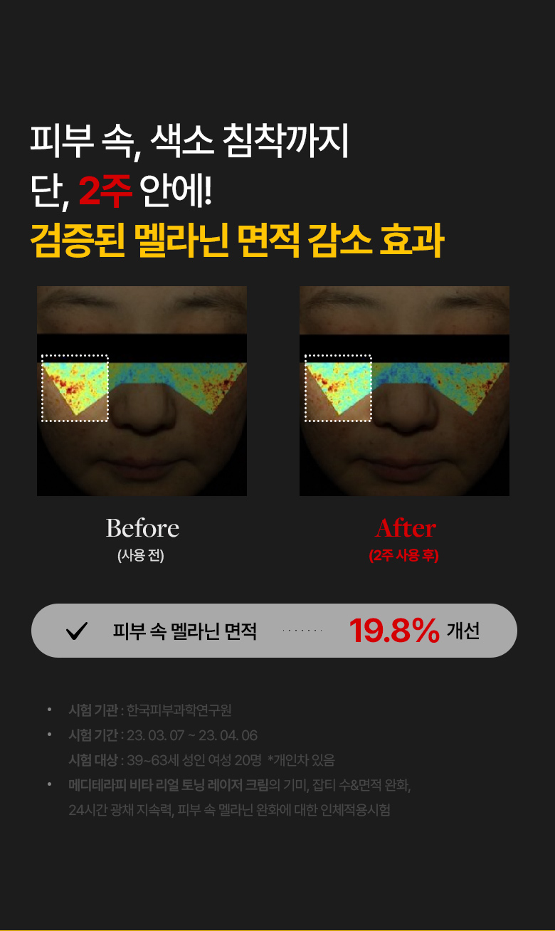meditherapy vita toning laser cream korean