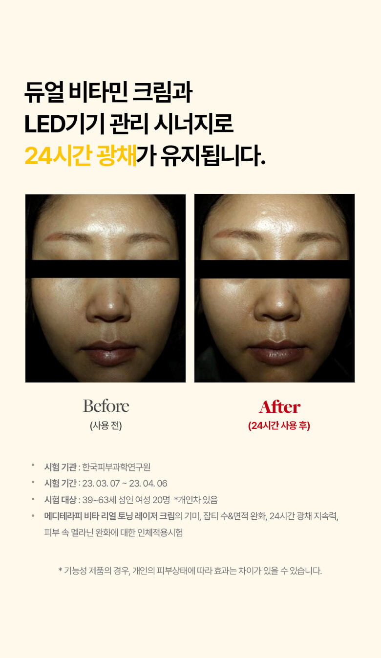 meditherapy vita toning laser cream korean