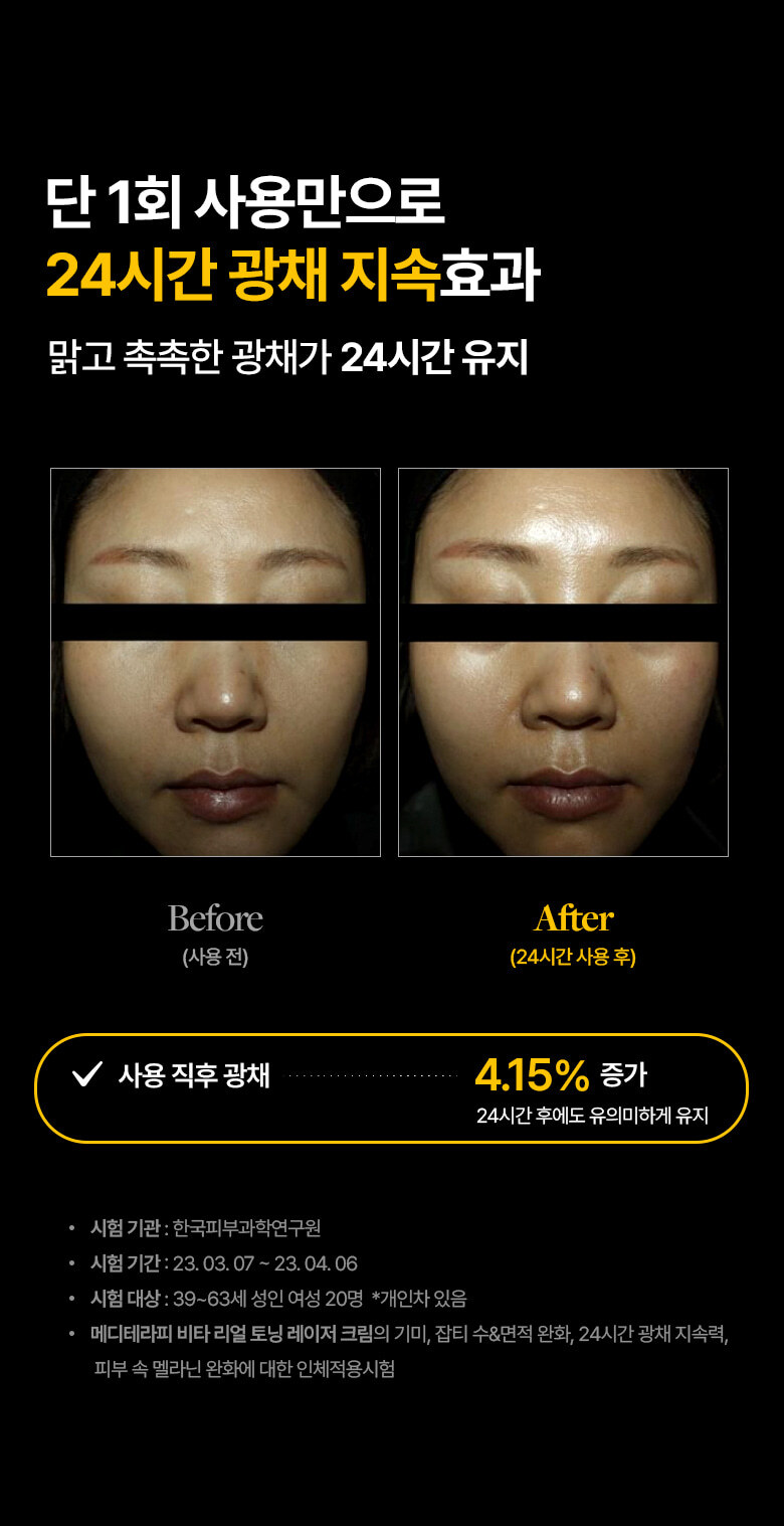 meditherapy vita toning laser cream korean