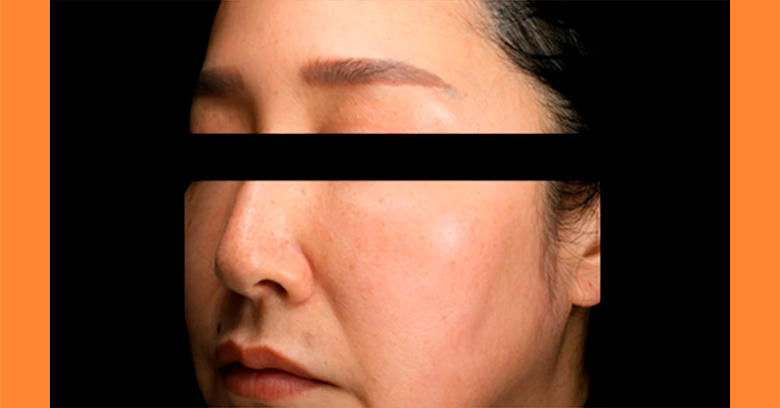 sérum vitamine c yuzu meditherapy k-beauty