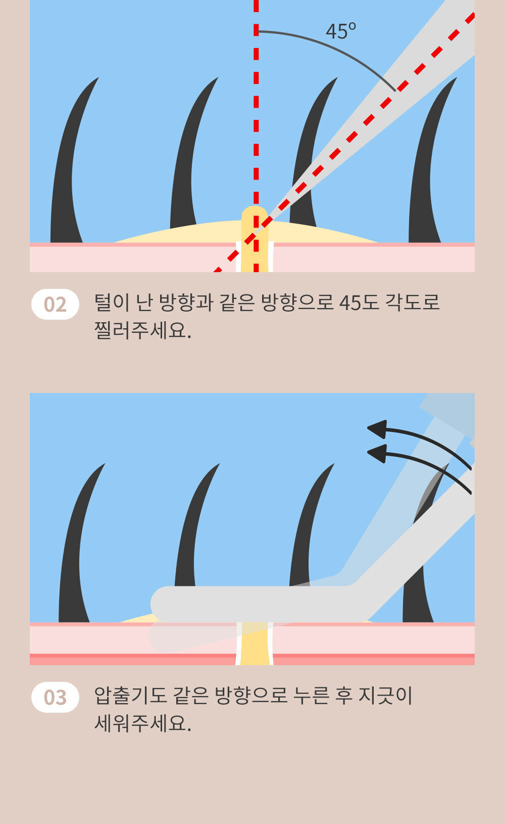 여드름 압출기 얼굴 코 피지 제거 상세 이미지 12