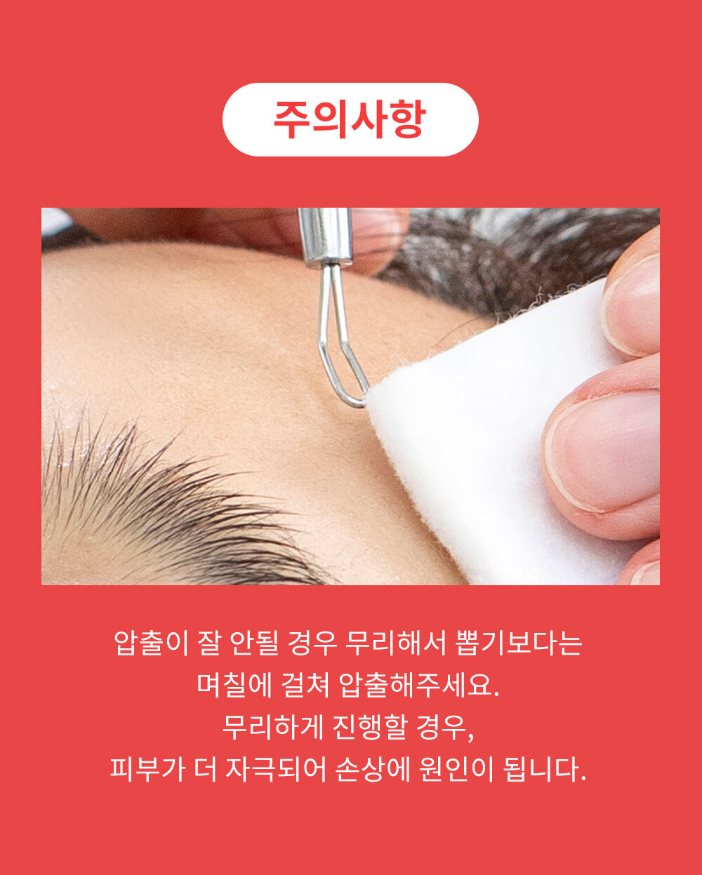 여드름 압출기 얼굴 코 피지 제거 상세 이미지 13