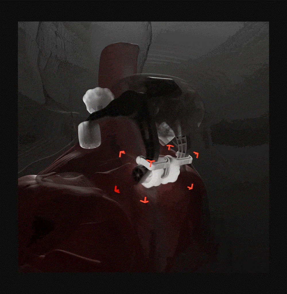 ZP5671_10.gif