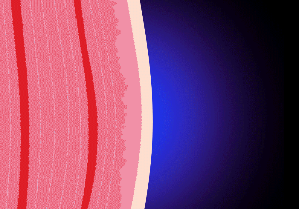 ZP5533_20.gif