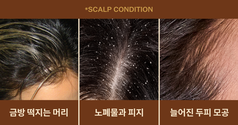 shampoing narka coréen