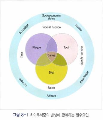 충치 발생에 관여하는 Keyes Triad 도식