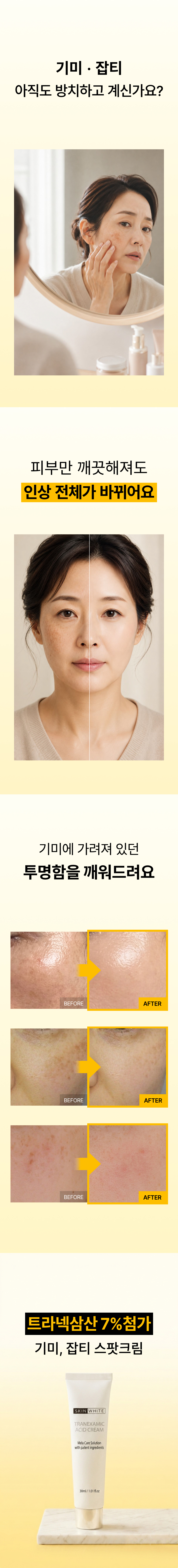 기미크림 트라넥삼산 7%