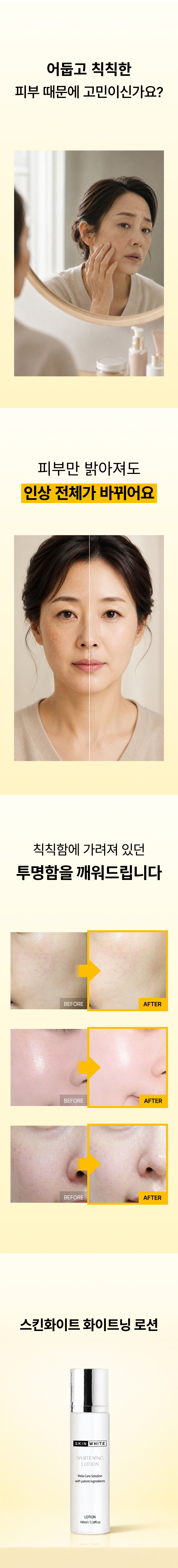 스킨화이트 미백 로션 100ml 화이트닝 에멀전 여름 기미 잡티
