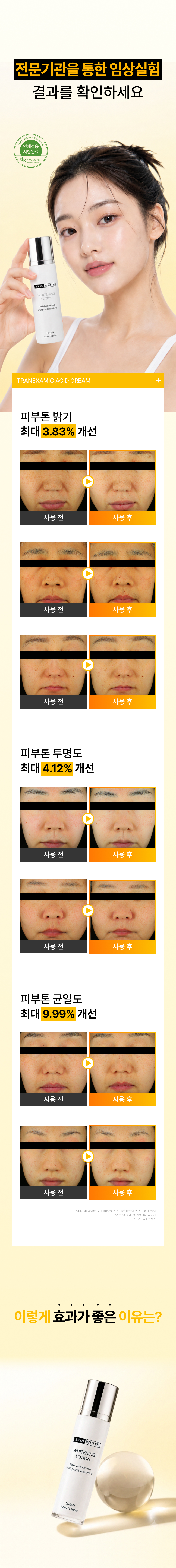 스킨화이트 미백 로션 100ml 화이트닝 에멀전 여름 기미 잡티
