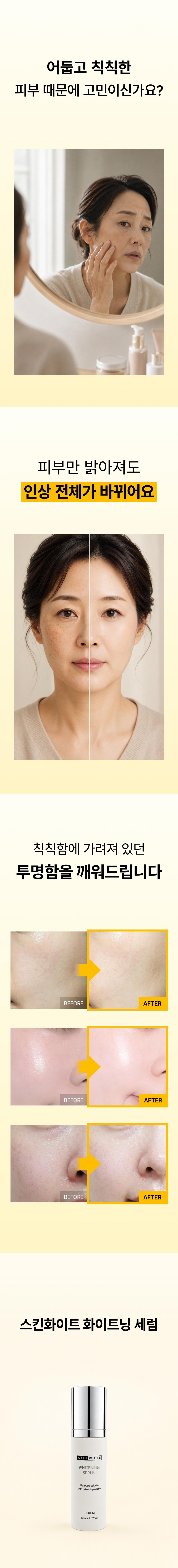 스킨화이트 미백 세럼 60ml 트라넥삼산 화이트닝 앰플 브라이트닝 에센스