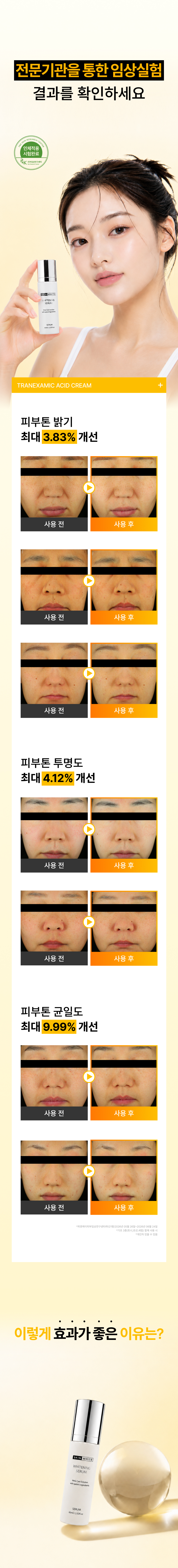 스킨화이트 미백 세럼 60ml 트라넥삼산 화이트닝 앰플 브라이트닝 에센스