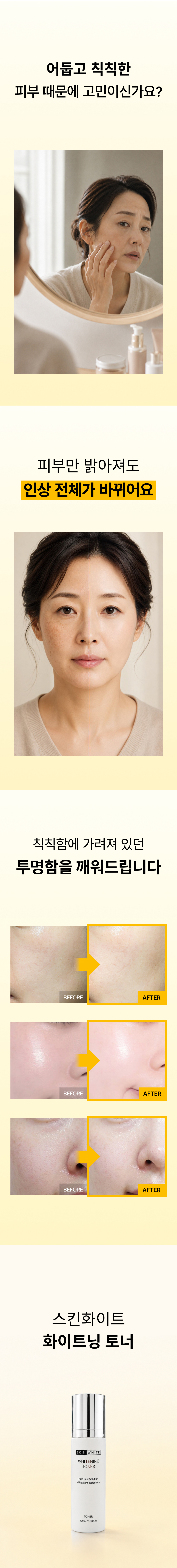 스킨화이트 미백 토너 100ml 화이트닝 스킨 여름 기미 잡티