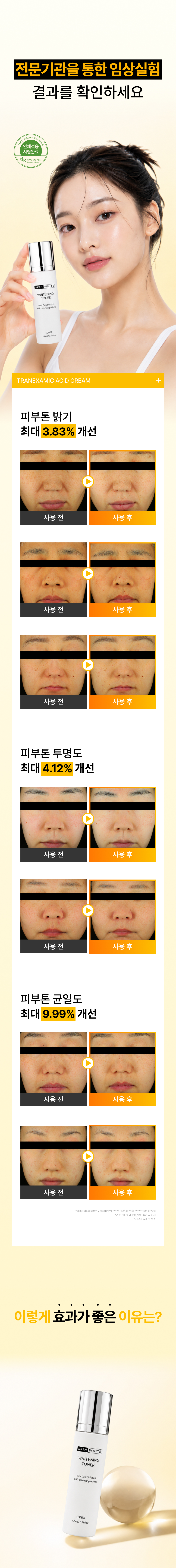 스킨화이트 미백 토너 100ml 화이트닝 스킨 여름 기미 잡티