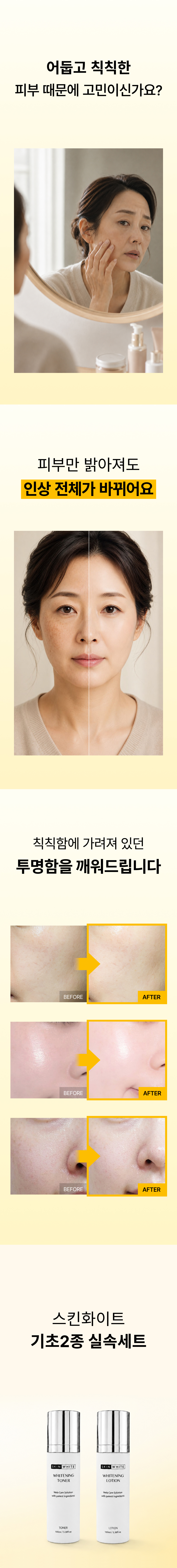 스킨화이트 기초2종 실속세트 미백 토너 로션 기미 화이트닝 스킨 에멀전