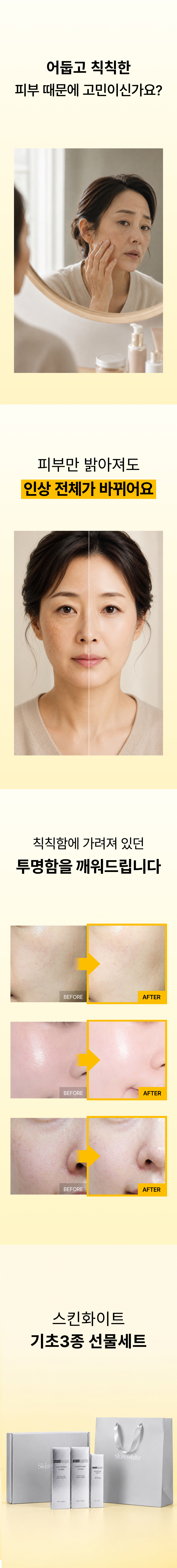 스킨화이트 기초3종 실속세트 미백 토너 로션 세럼 화이트닝