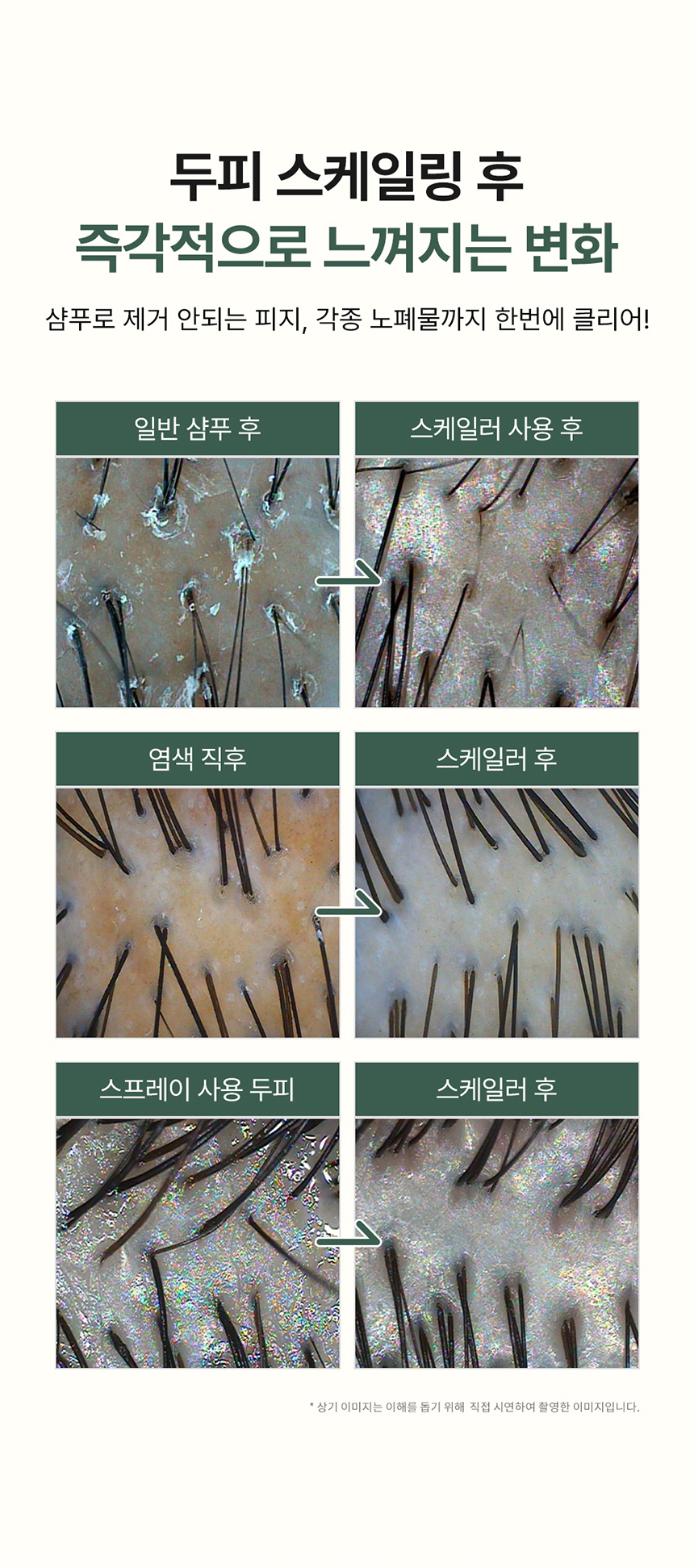 SOLEP Hair Root Aquapik Scalp Scaler 250ml - description 17